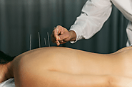 Acupuncture For Sciatica: Does It Really