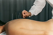 8 Powerful Ways Acupuncture Boosts Women’s Health Naturally