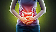 How Herbo-Mineral Remedies Benefit Ulcerative Colitis Treatment