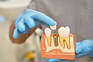 Best Dentist in Mahim East & West, Root Canal Treatment