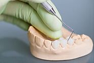 What is the Average Cost of Dental Implants in Pensacola