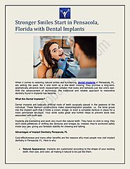 Stronger Smiles Start in Pensacola, Florida with Dental Implants