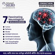 Dr. Udayan Narayan: Best Neurologist in Patna