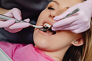 Why Should You Regularly Visit the Dentist in Deception Bay