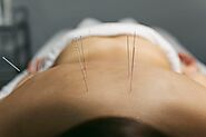 Natural Menopause Relief: Acupuncture in Frederick, MD