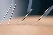 Lighting Upon The Acupuncture Pros To Women’s Fibromyalgia Pain!