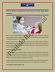 Why Do Medical Professionals Choose Cosmetic Bridge Teeth Above Implants.pdf