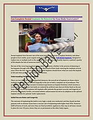 Can Complete Dental Implants Be Rejected by Your Body Years Later.pdf