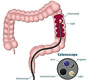 Best Colonoscopy Specialists in Downtown/Financial District