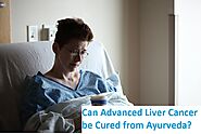 Can Advanced Liver Cancer Be Cured Through Ayurveda?