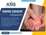 Bunion Surgery in Singapore