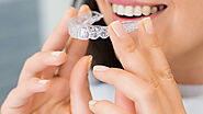 How Long Does Invisalign Treatment Take?