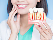 Dental Implant Recovery Timeline: What to Expect After Surgery?