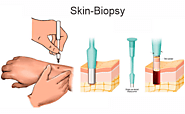 Skin Biopsy