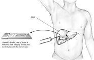 Liver hospital in ahmedabad