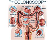 Best colonoscopy doctors in Ahmedabad - Mission Gastro Hospital