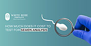 How Much Does it Cost to Test for Semen Analysis?