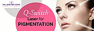 Q-Switch Laser for Pigmentation