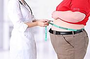 Comprehensive Guide About Stomach Surgery to Loss Weight