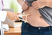 What is Obesity Surgery You Need to Know the Process