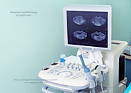 9936902 ultrasound guided biopsy of lymph node 185px