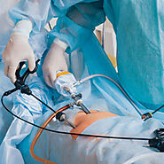 Laparoscopic Treatment in Chennai | Laparoscopic Surgery in Chennai | Complete Urology