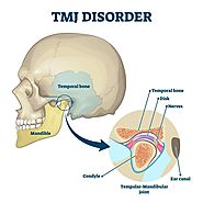 TMJ Disorders: Symptoms, Causes, and Physio TMJ Treatment | TMJ Syndrome