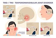 The TMJ Headache & Disorders: Identifying Causes and Finding Solutions | TMJ Headaches