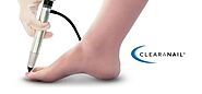 Clearanail Fungal Nail Solution | Safe, Painless, Effective