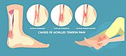 Blog 69 – Are You Wondering How To Cure Achilles Tendonitis Fast At Home? | Achilles Tendon Treatment