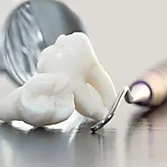 Expert Wisdom Teeth Removal in Burlington, ON