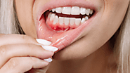 Gum Disease Treatment: Top 4 Benefits You Need to Know