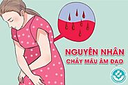 Điểm qua loạt nguyên nhân chảy máu âm đạo ở chị em