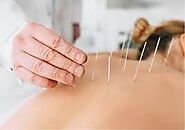 Relieve Muscle Pain with Dry Needling at Pure Chiro Dubai