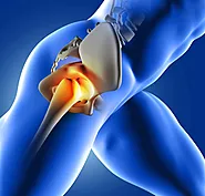 Understanding Piriformis Syndrome vs Discogenic Pain at Pure Chiro Dubai