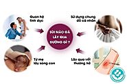 Sùi mào gà lây qua đường gì? 4 con đường cơ bản