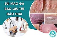 Sự thật về sùi mào gà bao lâu thì đào thải?