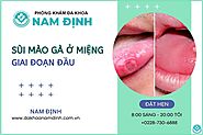 Vén màn bí mật: sùi mào gà lây qua nước bọt không?