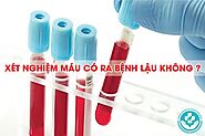 Sự thật về xét nghiệm máu có ra bệnh lậu không?