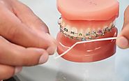 How to floss with braces best practices