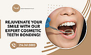 Get the Smile Makeover with Our Cosmetic Teeth Bonding!