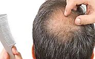 Best Hair Loss Treatment in Hyderabad - Dermiq Clinic