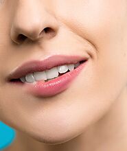 precios de implantes dentales