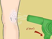 How to Treat Chigger Bites