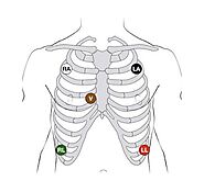 Mastering 5 Lead ECG Placement: Essential Tips For Accuracy