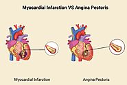 Difference Between Angina and MI