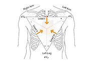 What are the different types of ECG leads?