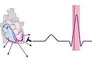 Understanding the R Wave ECG: Insights into Cardiac Health