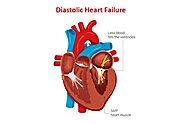 Understanding Diastolic Dysfunction Heart Failure