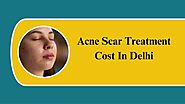 Cost Influencing Factors For Acne Scar Treatment 